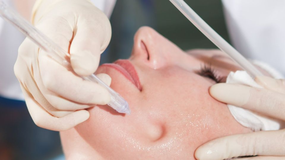 Smart Jet Peel